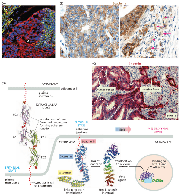 Effect of E-cadherin in the epithelial-mesenchymal transition.