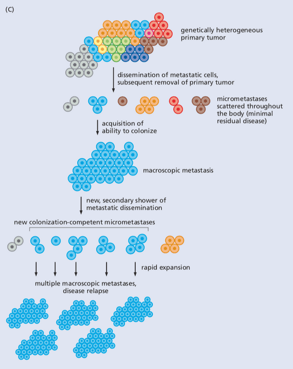 The cascade model that results in secondary metastasis.